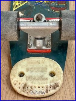 VIntage Gordon & Smith FibreFlex Skateboard Tracker Trucks Orig Build & Owner